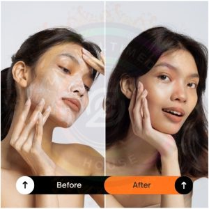 BeforeAfter Edits -Instagram Post Templates